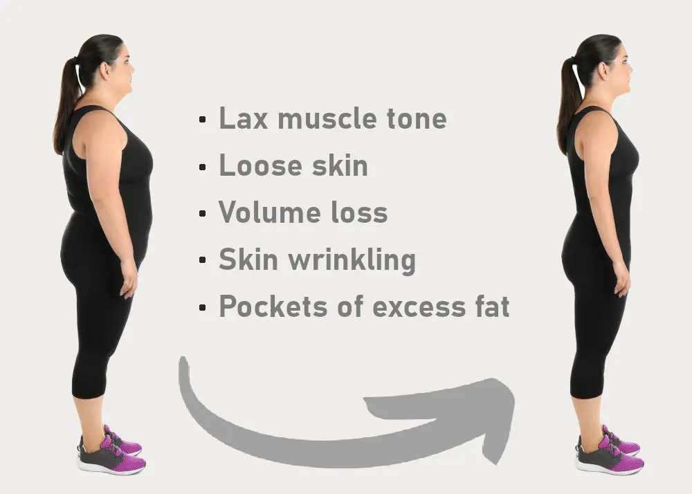 before and after weight loss