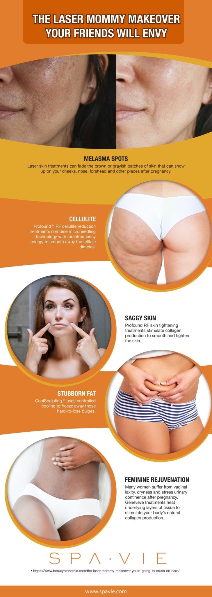 The Laser Mommy Makeover Your Friends Will Envy [Infographic]