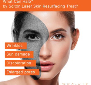 Harrington - HALO Laser Skin resurfacing
