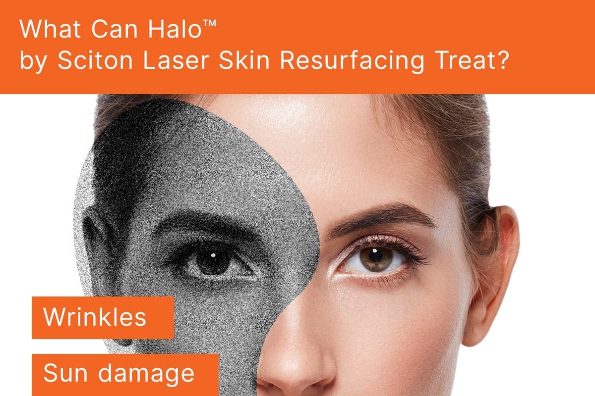 What Can Halo™ by Sciton Laser Skin Resurfacing Treat? [Infographic]