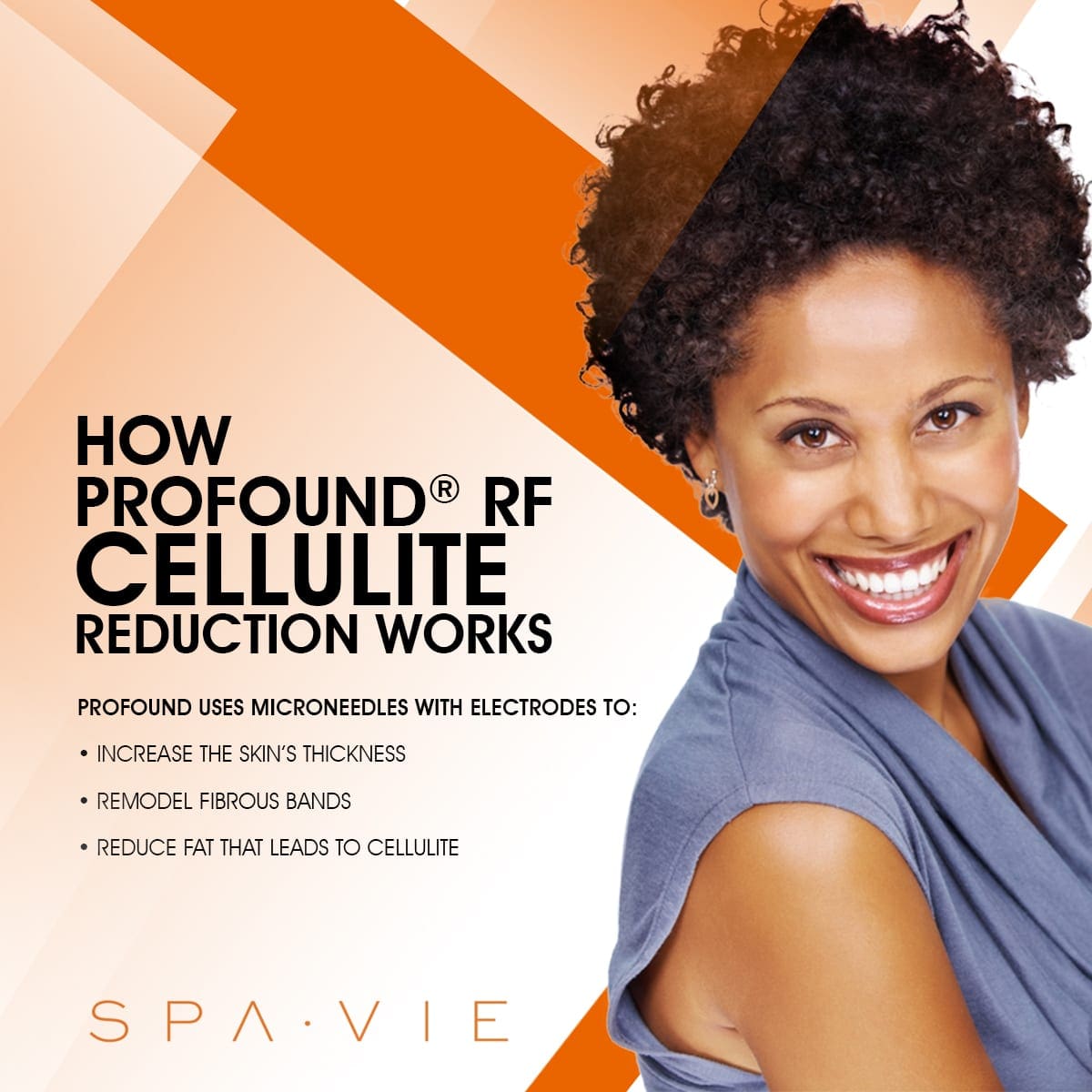 How Profound RF Cellulite Reduction Works infographic with woman smiling.