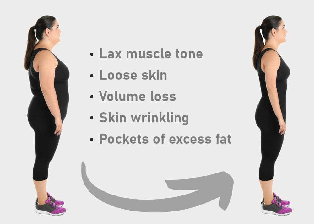 glp 1 utah GLP-1 Weight Loss Solutions